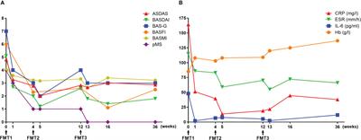 Case report: Fecal microbiota transplantation in refractory ankylosing spondylitis